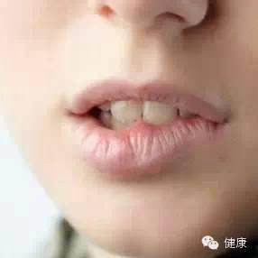 吃瓜口干咽喉发紧,口干咽喉发紧的解密与应对